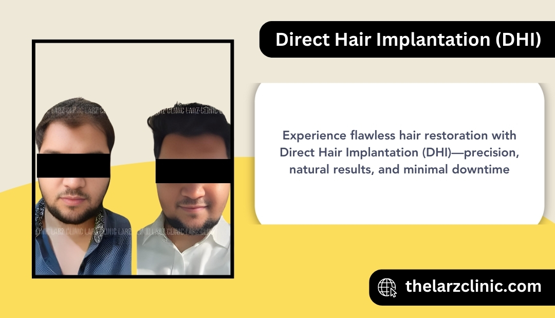 direct-hair-implantation-dhi-mira-road-mumbai
